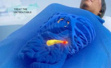 Treat the Untreatable